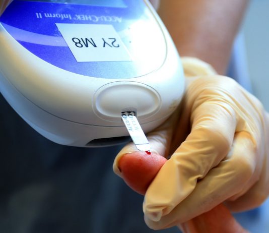 Five categories for adult diabetes, not just type 1 and type 2, study shows