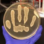 Common human skin bacteria could protect against cancer, say researchers