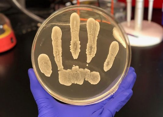 Common human skin bacteria could protect against cancer, say researchers