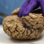 Growing brains in labs: why it’s time for an ethical debate