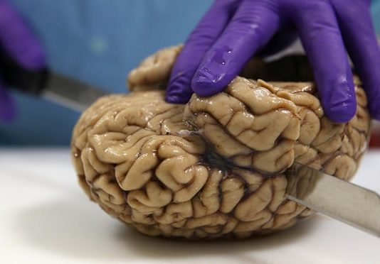 Growing brains in labs: why it’s time for an ethical debate